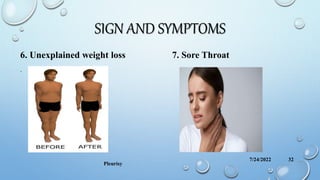 SIGN AND SYMPTOMS
6. Unexplained weight loss 7. Sore Throat
.
7/24/2022
Pleurisy
32
 