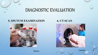 DIAGNOSTIC EVALUATION
5. SPUTUM EXAMINATION 6. CT SCAN
7/24/2022
Pleurisy 37
 