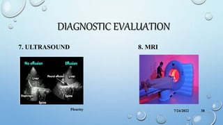 DIAGNOSTIC EVALUATION
7. ULTRASOUND 8. MRI
7/24/2022
Pleurisy 38
 