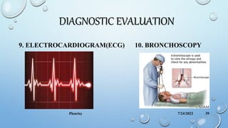 DIAGNOSTIC EVALUATION
9. ELECTROCARDIOGRAM(ECG) 10. BRONCHOSCOPY
7/24/2022
Pleurisy 39
 
