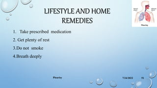 LIFESTYLE AND HOME
REMEDIES
1. Take prescribed medication
2. Get plenty of rest
3.Do not smoke
4.Breath deeply
7/24/2022
Pleurisy 51
 