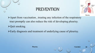 PREVENTION
Apart from vaccination , treating any infection of the respiratory
tract promptly can also reduce the risk of developing pleurisy.
Quit smoking.
Early diagnosis and treatment of underlying cause of pleurisy.
7/24/2022
Pleurisy 68
 