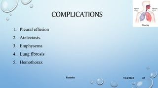 COMPLICATIONS
1. Pleural effusion
2. Atelectasis.
3. Emphysema
4. Lung fibrosis
5. Hemothorax
7/24/2022
Pleurisy 69
 
