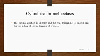 Cylindrical bronchiectasis
• The luminal dilation is uniform and the wall thickening is smooth and
there is failure of normal tapering of bronchi.
9
7/24/2022
 