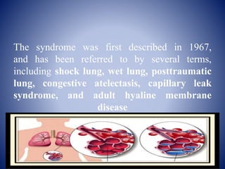 The syndrome was first described in 1967,
and has been referred to by several terms,
including shock lung, wet lung, posttraumatic
lung, congestive atelectasis, capillary leak
syndrome, and adult hyaline membrane
disease
 