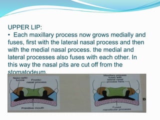 UPPER LIP:
• Each maxillary process now grows medially and
fuses, first with the lateral nasal process and then
with the medial nasal process. the medial and
lateral processes also fuses with each other. In
this way the nasal pits are cut off from the
stomatodeum.
 
