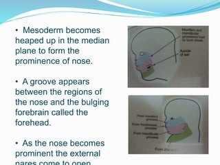 • Mesoderm becomes
heaped up in the median
plane to form the
prominence of nose.
• A groove appears
between the regions of
the nose and the bulging
forebrain called the
forehead.
• As the nose becomes
prominent the external
 