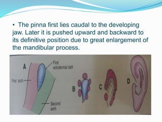 • The pinna first lies caudal to the developing
jaw. Later it is pushed upward and backward to
its definitive position due to great enlargement of
the mandibular process.
 