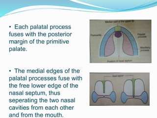 • Each palatal process
fuses with the posterior
margin of the primitive
palate.
• The medial edges of the
palatal processes fuse with
the free lower edge of the
nasal septum, thus
seperating the two nasal
cavities from each other
and from the mouth.
 