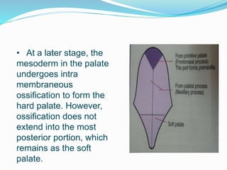• At a later stage, the
mesoderm in the palate
undergoes intra
membraneous
ossification to form the
hard palate. However,
ossification does not
extend into the most
posterior portion, which
remains as the soft
palate.
 