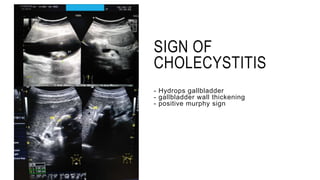 1. Abdominal Pain MARS 2.0 - dr. Siswidiyati, Sp.Rad.pptx