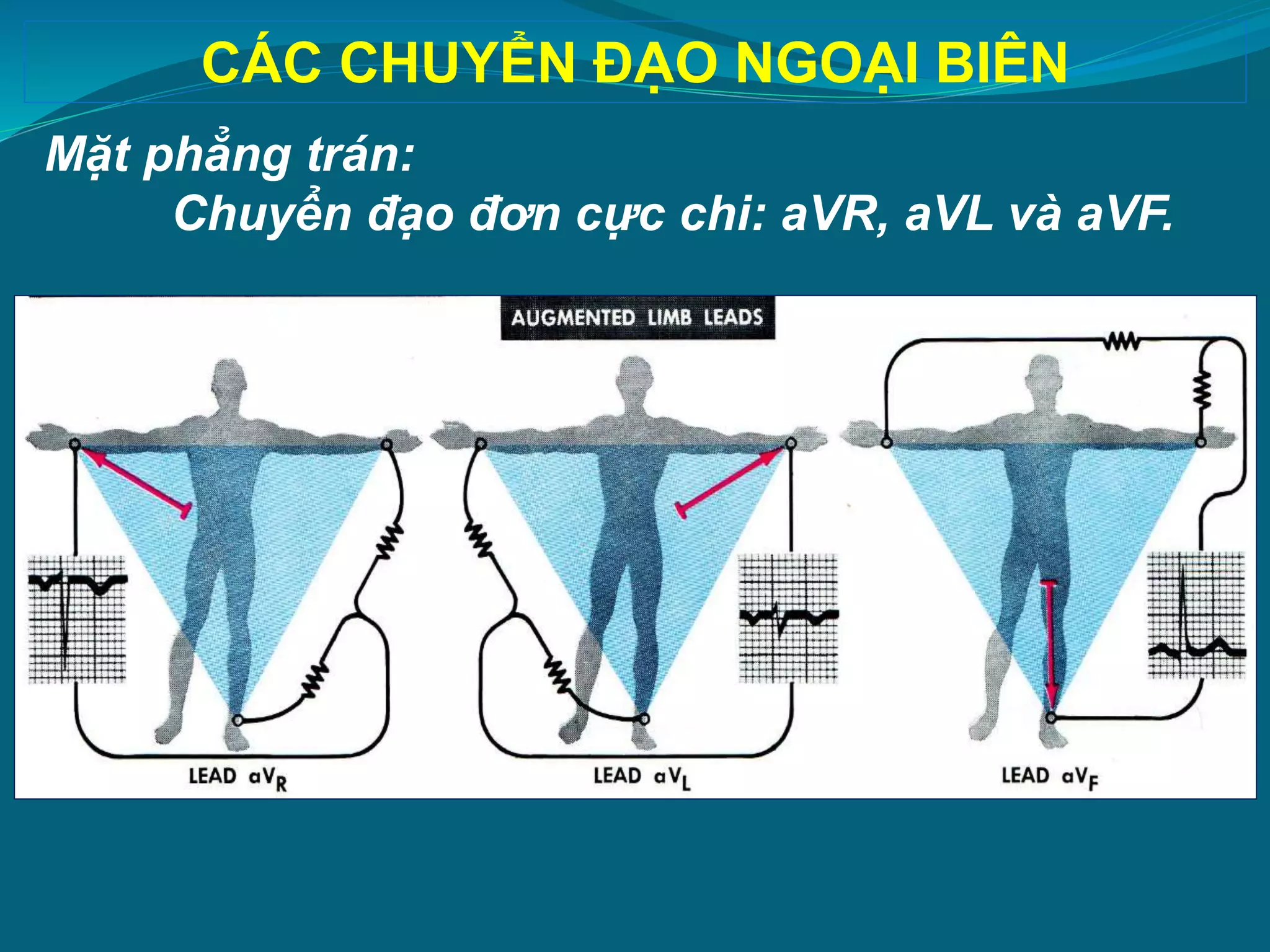 1. Tiếp cận ECG.pptx