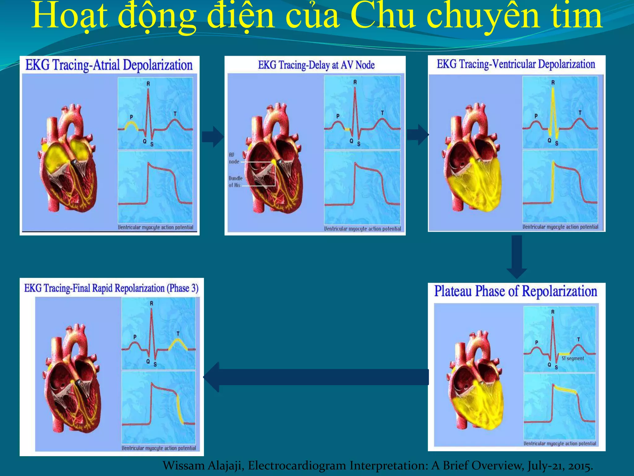 1. Tiếp cận ECG.pptx