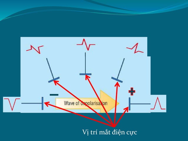 1. Tiếp cận ECG.pptx