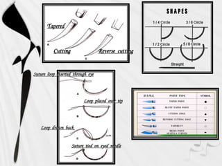 Tapered
Cutting Reverse cutting
Suture loop inserted through eye
Loop placed over tip
Loop drawn back
Suture tied on eyed needle
 