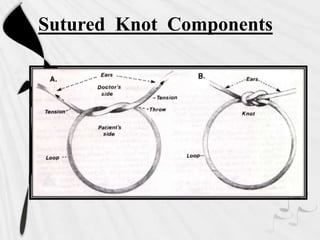 Sutured Knot Components
 