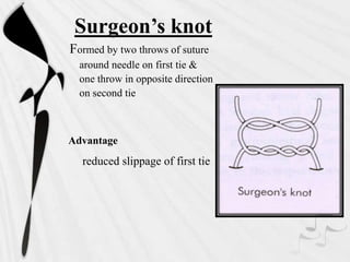 Surgeon’s knot
Formed by two throws of suture
around needle on first tie &
one throw in opposite direction
on second tie
Advantage
reduced slippage of first tie
 