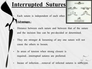 Interrupted Sutures
• Each suture is independent of each other.
• Advantages :
• Distance between each suture and between that of the suture
and the incision line can be pre-decided or determined.
• They are stronger & loosening of any one suture will not
cause the others to loosen.
• In areas of tension when strong closure is
required…interrupted sutures are preferred.
• Incase of infection….removal of infected sutures is sufficient.
 