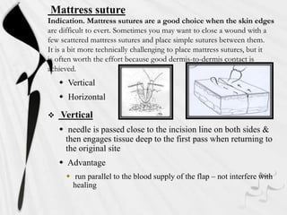 Mattress suture
Indication. Mattress sutures are a good choice when the skin edges
are difficult to evert. Sometimes you may want to close a wound with a
few scattered mattress sutures and place simple sutures between them.
It is a bit more technically challenging to place mattress sutures, but it
is often worth the effort because good dermis-to-dermis contact is
achieved.
 Vertical
 Horizontal
 Vertical
 needle is passed close to the incision line on both sides &
then engages tissue deep to the first pass when returning to
the original site
 Advantage
 run parallel to the blood supply of the flap – not interfere with
healing
 