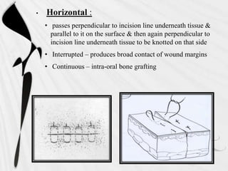 • Horizontal :
• passes perpendicular to incision line underneath tissue &
parallel to it on the surface & then again perpendicular to
incision line underneath tissue to be knotted on that side
• Interrupted – produces broad contact of wound margins
• Continuous – intra-oral bone grafting
 