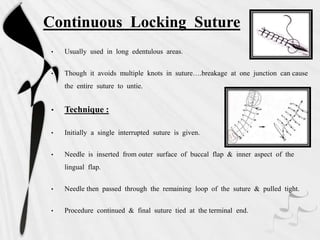 Continuous Locking Suture
• Usually used in long edentulous areas.
• Though it avoids multiple knots in suture….breakage at one junction can cause
the entire suture to untie.
• Technique :
• Initially a single interrupted suture is given.
• Needle is inserted from outer surface of buccal flap & inner aspect of the
lingual flap.
• Needle then passed through the remaining loop of the suture & pulled tight.
• Procedure continued & final suture tied at the terminal end.
 