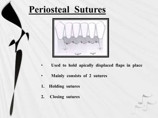Periosteal Sutures
• Used to hold apically displaced flaps in place
• Mainly consists of 2 sutures
1. Holding sutures
2. Closing sutures
 