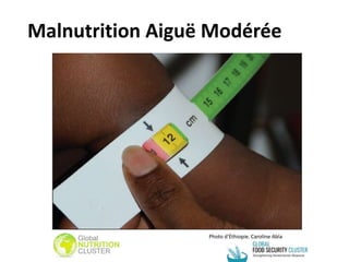 Photo d'Éthiopie. Caroline Abla
Malnutrition Aiguë Modérée
 
