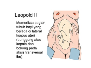 Memeriksa bagian
tubuh bayi yang
berada di lateral
korpus uteri
(punggung atau
kepala dan
bokong pada
aksis transversal
ibu)
Leopold II
 