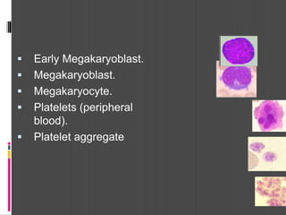  Early Megakaryoblast.
 Megakaryoblast.
 Megakaryocyte.
 Platelets (peripheral
blood).
 Platelet aggregate
 