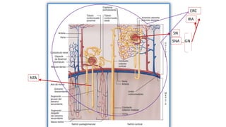 NTA
SN
ERC
IRA
SNA GN
 