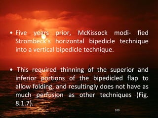 • Five years prior, McKissock modi- fied
Strombeck’s horizontal bipedicle technique
into a vertical bipedicle technique.
• This required thinning of the superior and
inferior portions of the bipedicled flap to
allow folding, and resultingly does not have as
much perfusion as other techniques (Fig.
8.1.7).
100
 