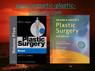 www.cosmetic-plastic-
surgery.com
116
 