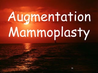 Augmentation
Mammoplasty
16
 