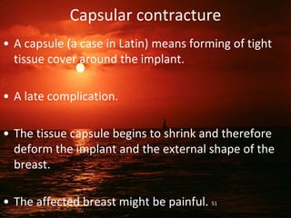 Capsular contracture
• A capsule (a case in Latin) means forming of tight
tissue cover around the implant.
• A late complication.
• The tissue capsule begins to shrink and therefore
deform the implant and the external shape of the
breast.
• The affected breast might be painful. 51
 
