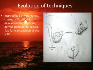 Evolution of techniques -
• Inspired by Schwarzmann’s
concepts, Strombeck
developed his horizontal,
dermo-glandular bi-pedicle
flap for transposition of the
NAC.
79
 