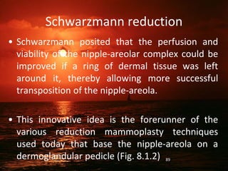 Schwarzmann reduction
• Schwarzmann posited that the perfusion and
viability of the nipple-areolar complex could be
improved if a ring of dermal tissue was left
around it, thereby allowing more successful
transposition of the nipple-areola.
• This innovative idea is the forerunner of the
various reduction mammoplasty techniques
used today that base the nipple-areola on a
dermoglandular pedicle (Fig. 8.1.2) 89
 
