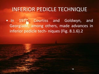 INFERIOR PEDICLE TECHNIQUE
• In 1977, Courtiss and Goldwyn, and
Georgiade, among others, made advances in
inferior pedicle tech- niques (Fig. 8.1.6).2
98
 