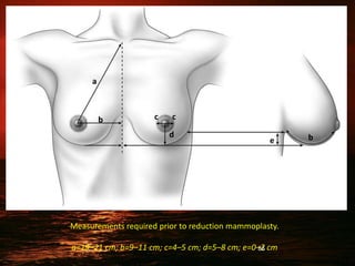 1.Augmentation & reduction mammoplasty (2).pptx