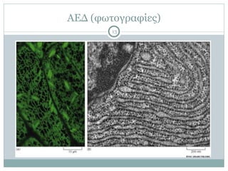 ΑΕΔ (φωτογραφίες)
13
 