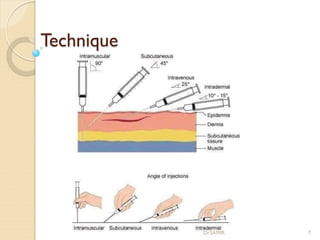 Technique
Dr.SAMIR 7
 