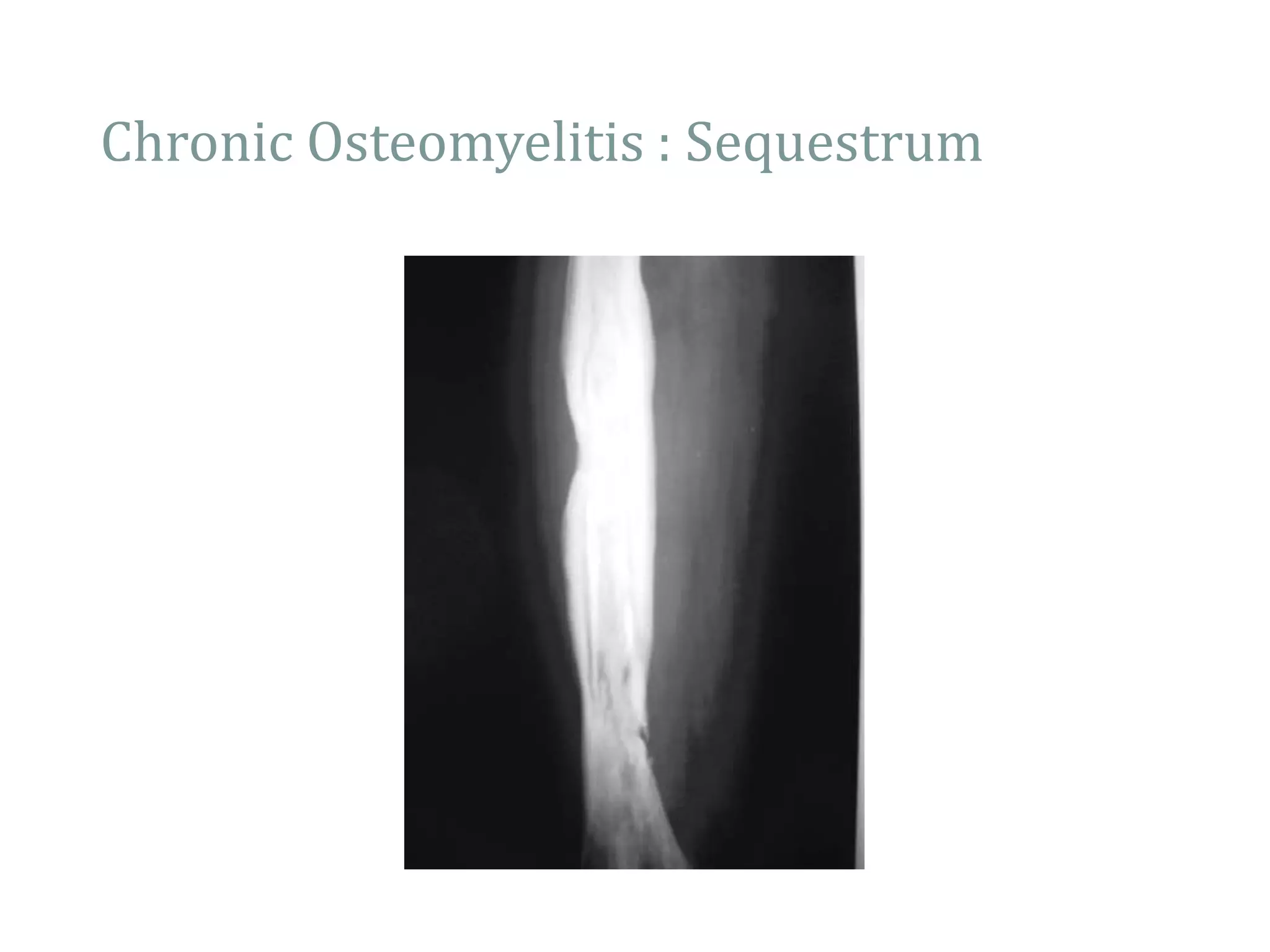 1. Introduction to Orthopaedics.ppt