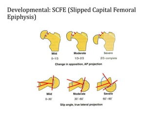 1. Introduction to Orthopaedics.ppt