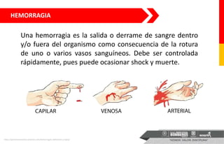 HEMORRAGIA
Una hemorragia es la salida o derrame de sangre dentro
y/o fuera del organismo como consecuencia de la rotura
d...