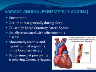 VARIANT ANGINA (PRINZMETAL’S ANGINA)
 Uncommon
 Occurs at rest generally during sleep
 Caused by Large Coronary Artery Spasm
 Usually associated with atheromatous
disease
 Abnormally reactive and
hypertrophied segments
in the Coronary Artery
 Drugs aimed at preventing
& relieving Coronary Spasm.
 