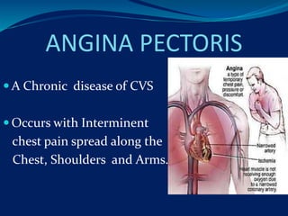 ANGINA PECTORIS
 A Chronic disease of CVS
 Occurs with Interminent
chest pain spread along the
Chest, Shoulders and Arms.
 