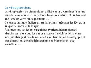 La vitropression:
La vitropression ou diascopie est utilisée pour déterminer la nature
vasculaire ou non vasculaire d’une ...