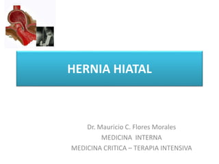 HERNIA HIATAL
Dr. Mauricio C. Flores Morales
MEDICINA INTERNA
MEDICINA CRITICA – TERAPIA INTENSIVA
 