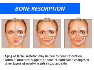 1. dr. Hendra - Basic Knowledge of The Wrinkles Final A .ppt.pdf