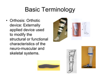 1.Introduction to P&O material-Teminilogy - presentation 2.ppt