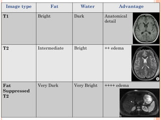 T2 Ranges Mri Basic about radiology & imaging.pdf